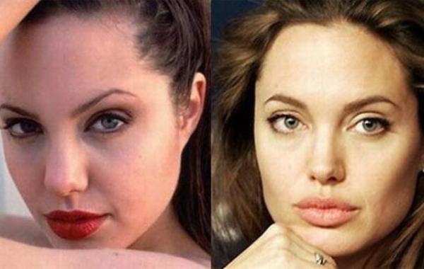 Голливудские знаменитости до и после пластической хирургии