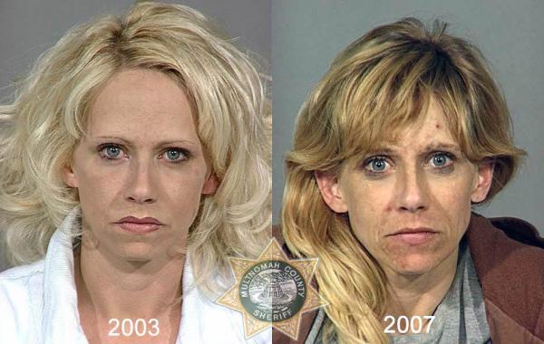 Последствия употребления тяжелых наркотиков