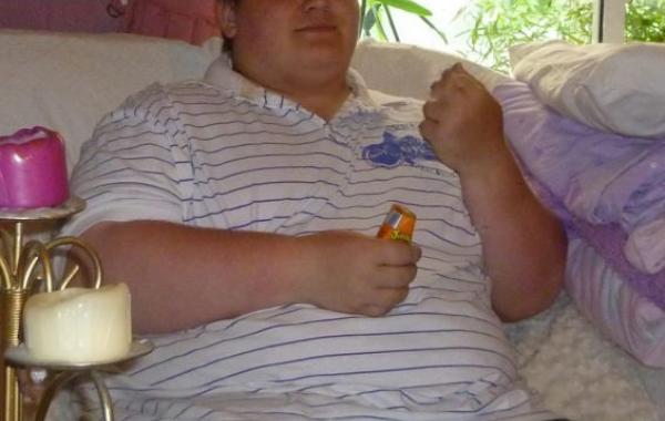 Парень похудел на 108 кг, но в операции по удалению лишней кожи ему отказывают