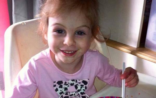 3-летнюю девочку, изуродованную питбулями, выгнали из закусочной, из-за её внешности