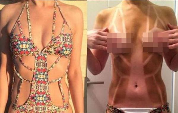 Тела девушек до и после того, как они позагорали в купальниках