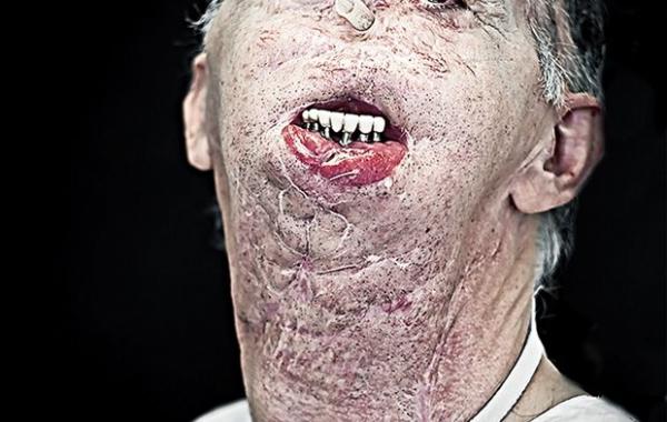 Сирил Кейн Cyril Caine, люди после реконструкции лица