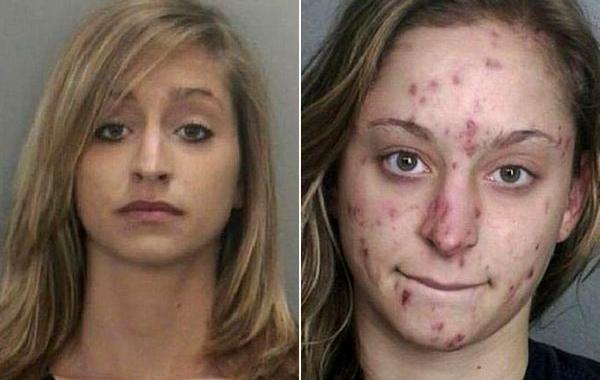 Лица до и после метамфетамина, люди до и после метамфетамина