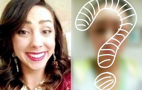 аллергическая реакция на краску для волос, аллергия на краску для волос, лицо опухло аллергия краска для волос