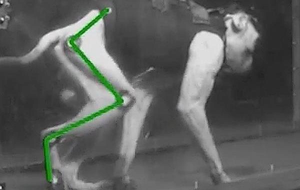 имплант в мозг макаки, имплант позволит парализованным людям ходить