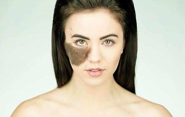 девушка с огромной родинкой, Кассандра Нод, Cassandra Naud, девушка отказалась удалять огромную родинку, огромная родинка на лице