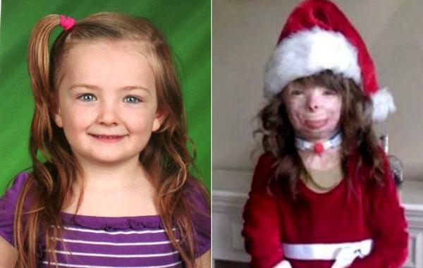 Сафайр Терри, Safyre Terry, обгоревшая девочка рождественские открытки, обгоревшая девочка просит прислать открытки на Рождество