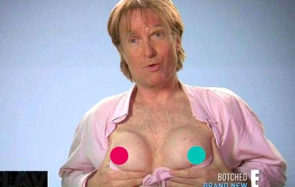 Брайан Зембик, Brian Zembic, мужчина силиконовая грудь на спор, установил на спор грудные импланты, установил в грудь импланты за 100000 долларов