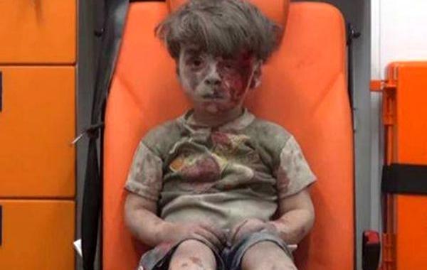 раненый сирийский мальчик сегодня, как сейчас выглядит сирийский мальчик