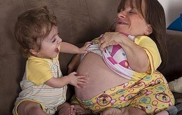 Стейси Геральд, Stacey Herald, самая маленькая мама в мире, Мама с несовершенным остеогенезом