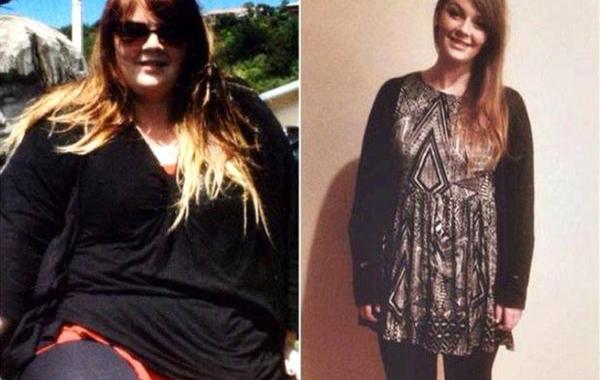 лишние складки кожи после похудения, рулоны лишней кожи, лишняя кожа после похудения