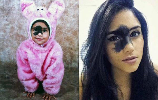 Мариана Мендес, Mariana Mendes, девушка с родимым пятном на лице, огромное родимое пятно на лице, огромная родина на лице