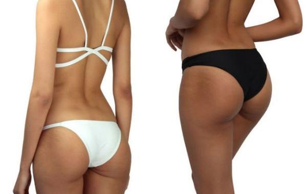 модели с растяжками, реальные фотографии моделей, модели без фотошопа