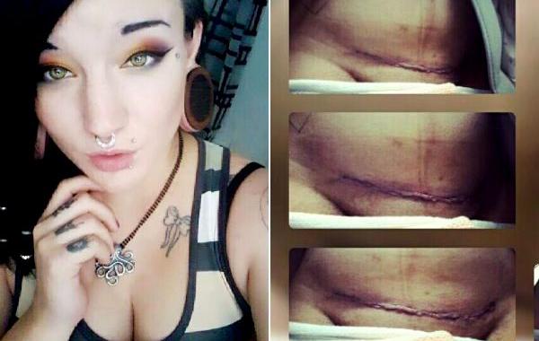 кесарево сечение лёгкий путь,женщина ответ на кесарево сечение это легко