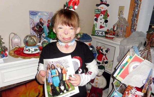 Сафайр Терри, Safyre Terry, обгоревшая девочка рождественские открытки, обгоревшая девочка получила рождественские открытки