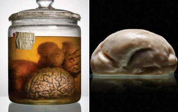 мозги психбольницы Техаса, мозги пациентов в банках, Адам Вурхес,Adam Voorhes