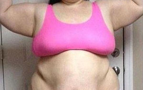 девушка похудела на 95 кг, похудела осталась лишняя кожа, после похудения осталась лишняя кожа, Кейтлин Смит