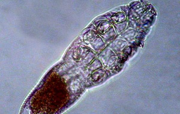 demodex, демодекс, железница, клещи на лице, клещи живут на нашем лице