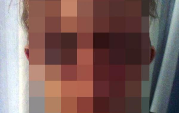 Лицо ученого, после того как его избили четыре грабителя, ворвавшихся в его дом