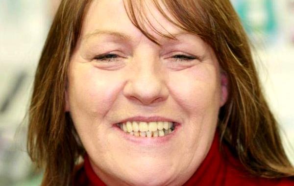 Энджи Барлоу, Angie Barlow, женщина 10 лет не ходила к стоматологу, женщина приклеивала суперклеем зубы, не ходила к стоматологу 10 лет