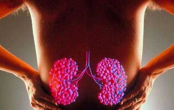 Хи Донг, He Dong, 420 камней в почках, врачи удалили 420 камней из почек