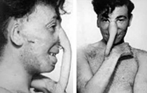 Сумасшедшие способы лечения, в существование которых трудно поверить