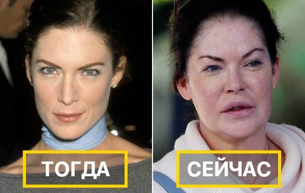 до и после пластических операций, неудачная пластика звёзд