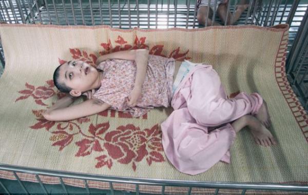 Последствия использования Agent Orange во Вьетнаме