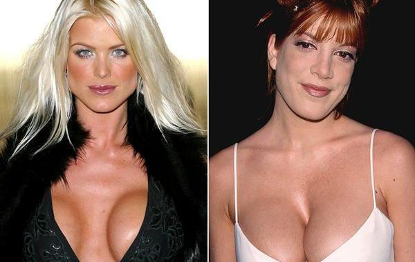 неудачная пластика груди. неудачные пластические операции 