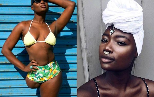 Девушке с ампутированной ногой оставалось жить всего 3 недели, девушка без ноги стала блогером и моделью,  Мама Какс, Mama Cax