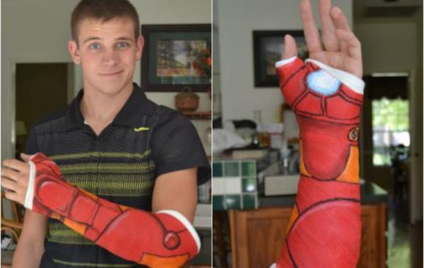 Умопомрачительные творческие риснуки на гипсе, ради которых стоит ломать кости