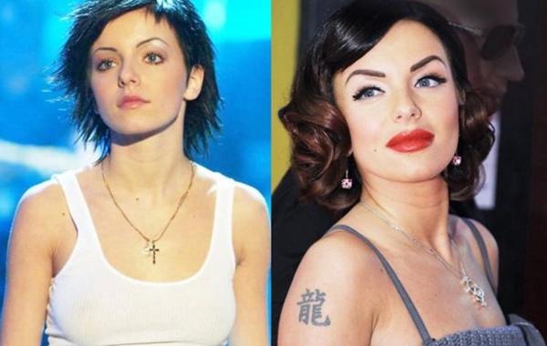 Самые неудачные пластические операции российских знаменитостей