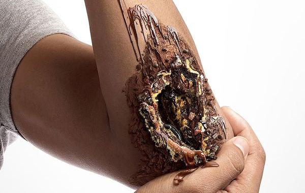 сладкое убивает, Ассоциация Диабета Таиланда, Наттаконг Джангсем, Nattakong Jaengsem