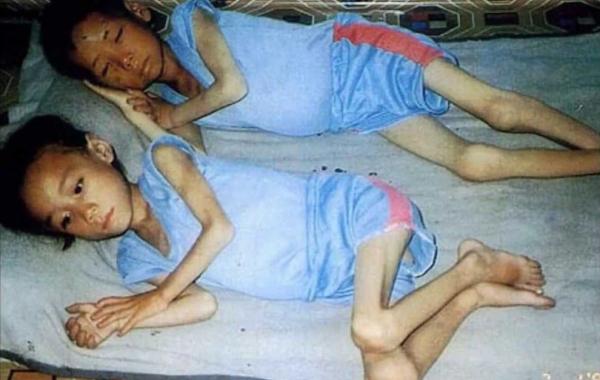 Случаи голода, которые привели к канибализму