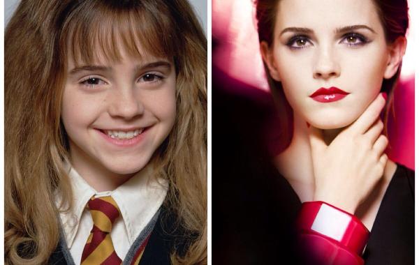 Из ботанов в секс-символы. Как изменились с возрастом неприглядные знаменитые дети-актеры