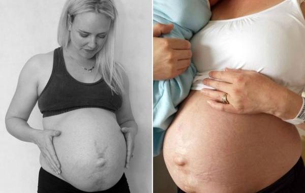 Джули Босейл, Julie Bhosale, реальное послеродовое тело, тело женщины после родов, тело после родов 14 дней