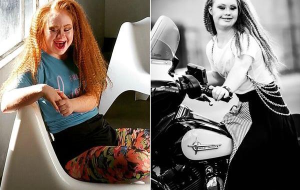 Маделин Стюарт, Madeline Stuart, модель с синдромом дауна