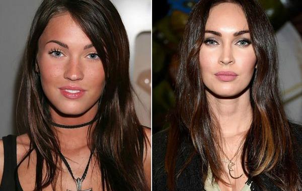 пластические операции звёзд, звёзды сделавшие пластические операции в юном возрасте