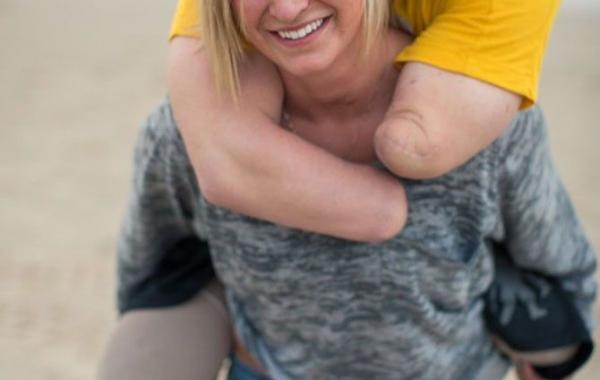 Вдохновляющие истории об инвалидах, которые не сдались