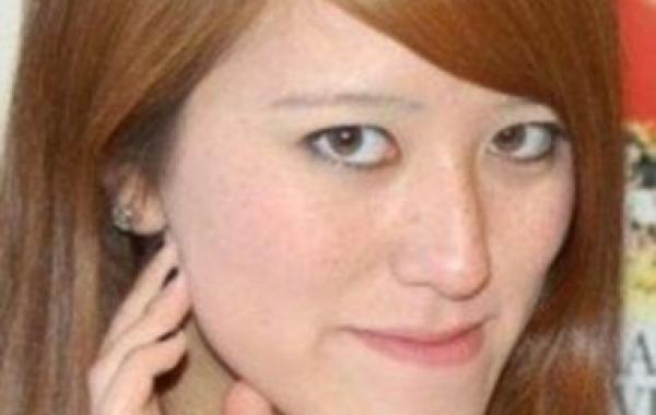 Софи Йейтс новое лицо пластическая ортогнатическая хирургия