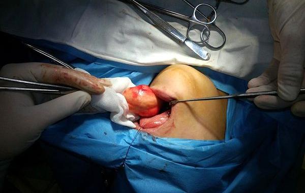 факты о человеке, познавательные факты о человеческом теле