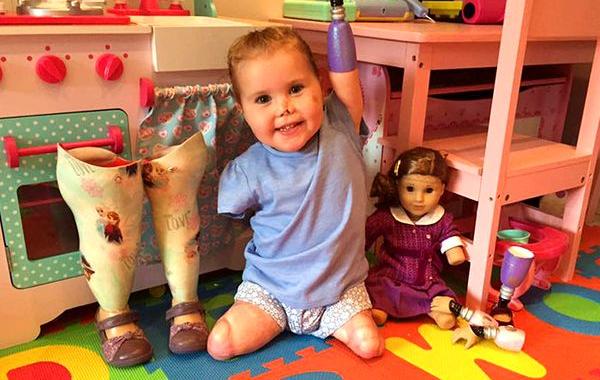 2-летняя девочка без рук и ног получила куклу-инвалида, кукла-ампутант, кукла-инвалид