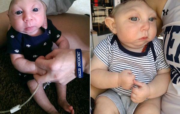 ребёнок без части мозга и черепа, сильный Джексон