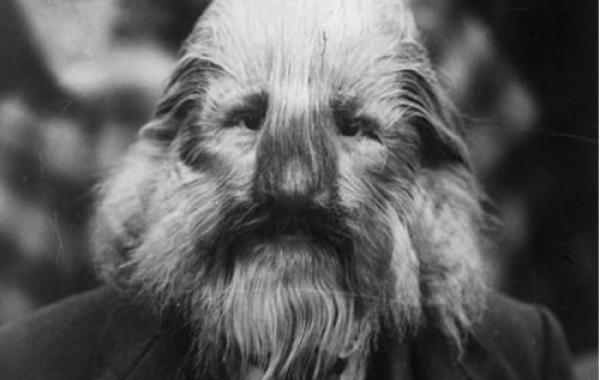 фрик-шоу, цирк уродов, физические дефекты, винтажные фотографии