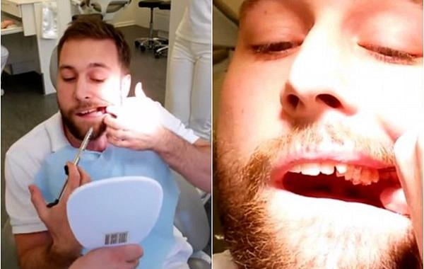 Джеспер Райлтофт, Jesper Ryltoft, парень удалил себе зуб мудрости