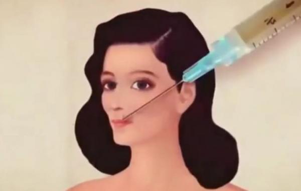 Supervenus, Фредерик Доазан, Frederic Doazan, к чему приводят пластические операции