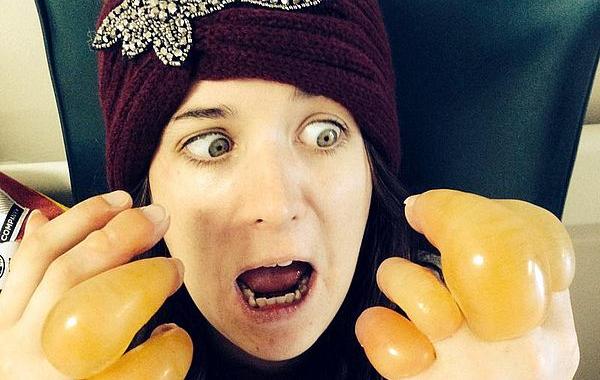 пальцы после обморожения, австралийка обморозила пальцы, сильное обморожение пальцев австралийки, отек после обморожения