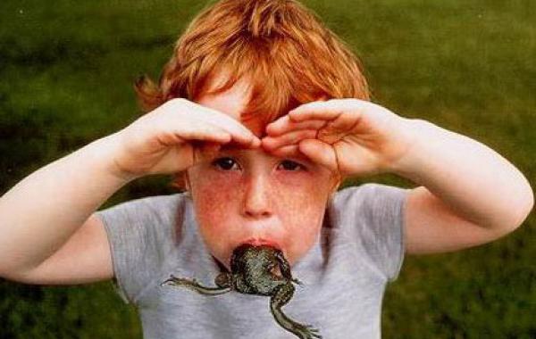 Самые необычные медицинские синдромы