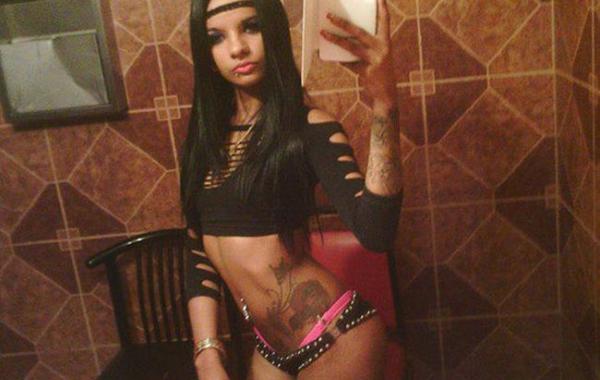 после увеличения груди девушка впала в кому и стала инвалидом, linda perez