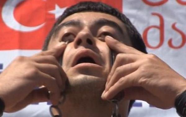 33 кг глазницами, Лачил Абдул Гусейнов рекорд